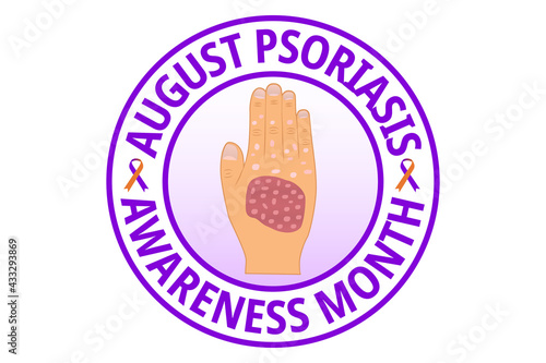 August psoriasis awareness month flat vector illustration. A health design for banner, poster, web. Protection, healthcare, prevention concept.