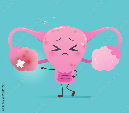 Illustration uterus inflamed ovary against a blue and white background. Vector cute style cartoon character illustration for applications medical website. The concept of prevent cervical cancer. photo
