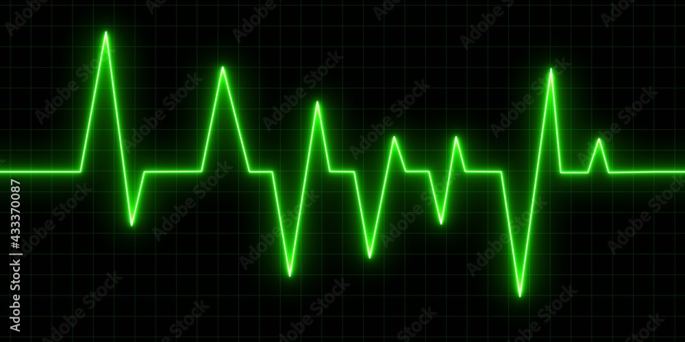 heart beat on monitor heart beat on monitor