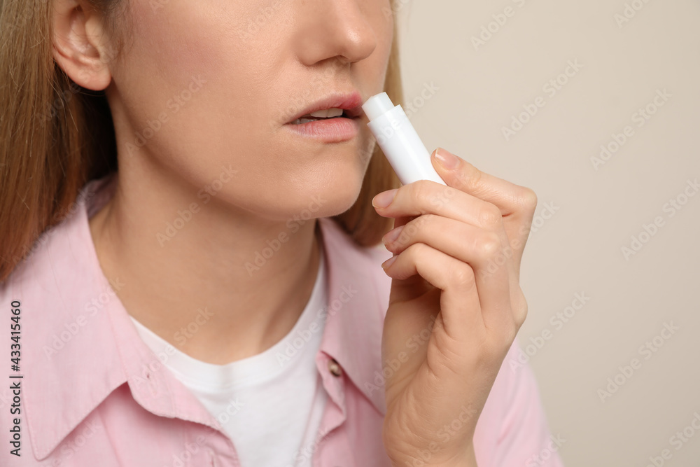 Woman with herpes applying lip balm against beige background, closeup Woman with herpes applying lip balm against beige background, closeup