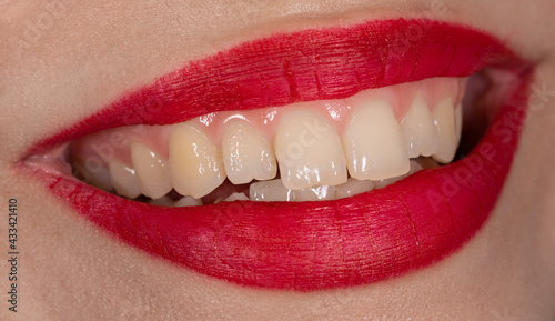 Close-up macro view of a woman's beautiful set of teeth and red lips.
