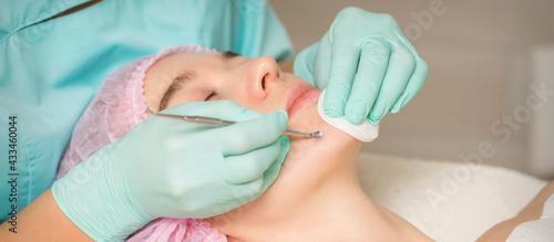 Facial cleansing. Blackhead Removal Tool. Beautician removing blackhead and acne on female chin in a beauty salon