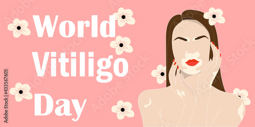 Beauty woman with vitiligo. Contemporary portrait of adorable girl on pink background. Flat vector illustration.