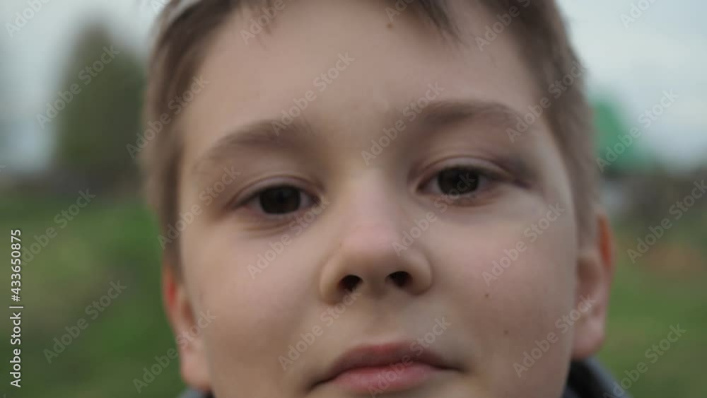 a cheeky boy with a black eye.the aftermath of the fight. at the end, he makes a face a cheeky boy with a black eye.the aftermath of the fight. at the end, he makes a face