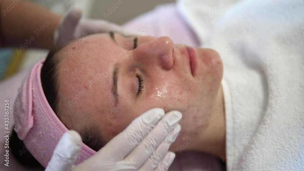 Beautician applying cold hydrogenation gel with cotton pads on face of young woman for acne treatment in beauty spa salon Beautician applying cold hydrogenation gel with cotton pads on face of young woman for acne treatment in beauty spa salon