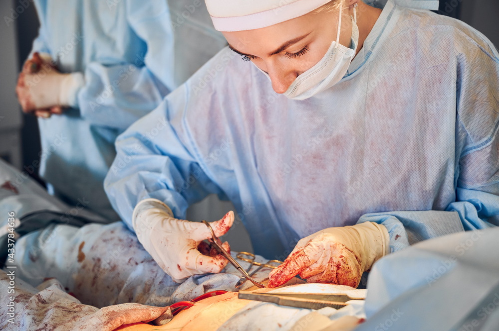 Close up of young female surgeon in sterile gloves cutting thread with scissors while placing sutures after tummy tuck surgery. Woman doctor in surgical uniform performing abdominal plastic surgery.