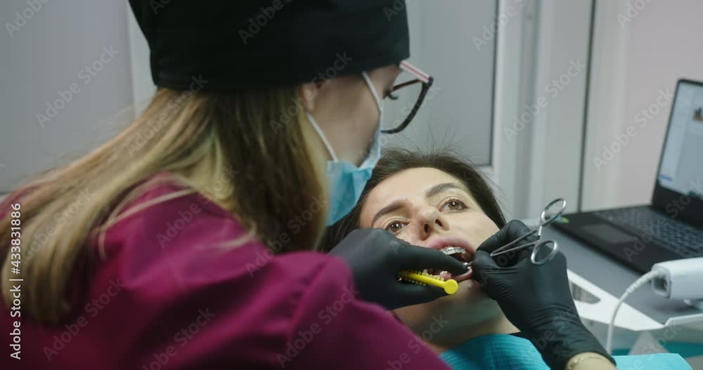 The process of putting on colored rubber bands for braces ligatures