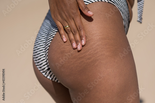 Close up shot of woman touching her stretch marks photo