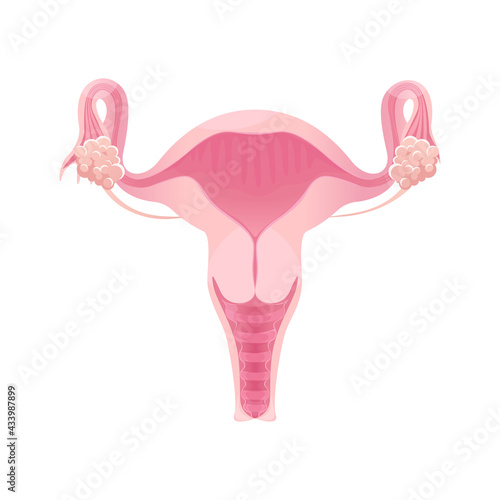 Anatomy of the female reproductive system. The layout of the female reproductive organs: uterus, cervix, ovary, fallopian tube.