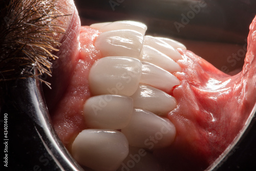 Closeup healthy men dental smile