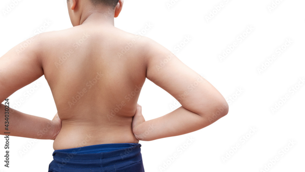 Asian kid with scoliosis Asian kid with scoliosis