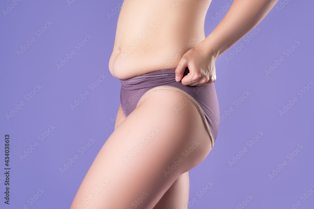 Fat woman in corrective panties, flabby belly after pregnancy, overweight female body on purple background