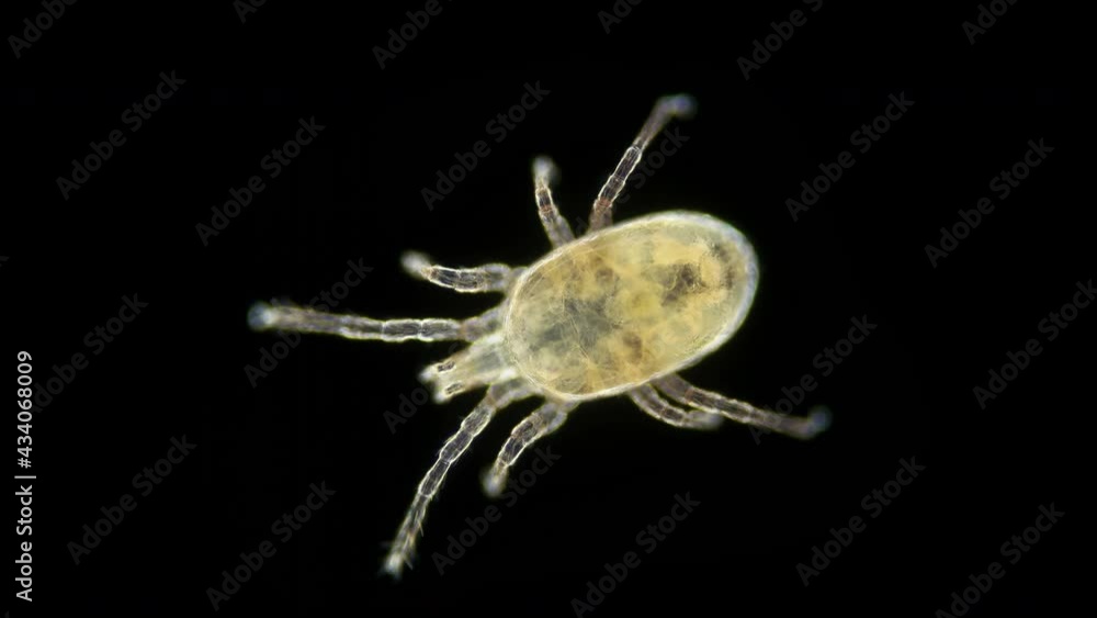 Mite of the order Mesostigmata under a microscope, class Arachnida, superorder Parasitiformes Mite of the order Mesostigmata under a microscope, class Arachnida, superorder Parasitiformes