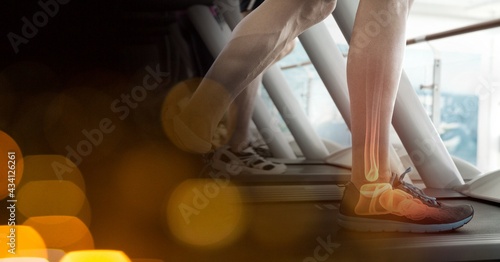 Composition of man running on treadmill with leg bones visible and spots of light