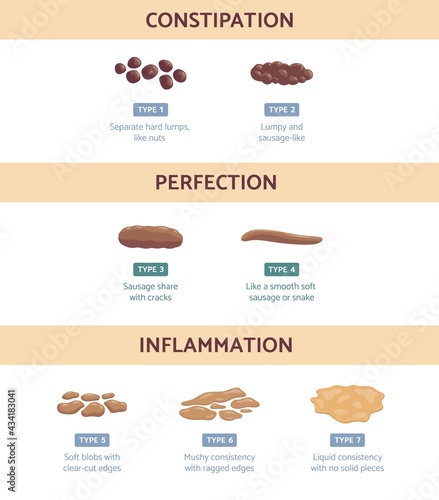 Bristol stool chart with medicine description of type human feces.