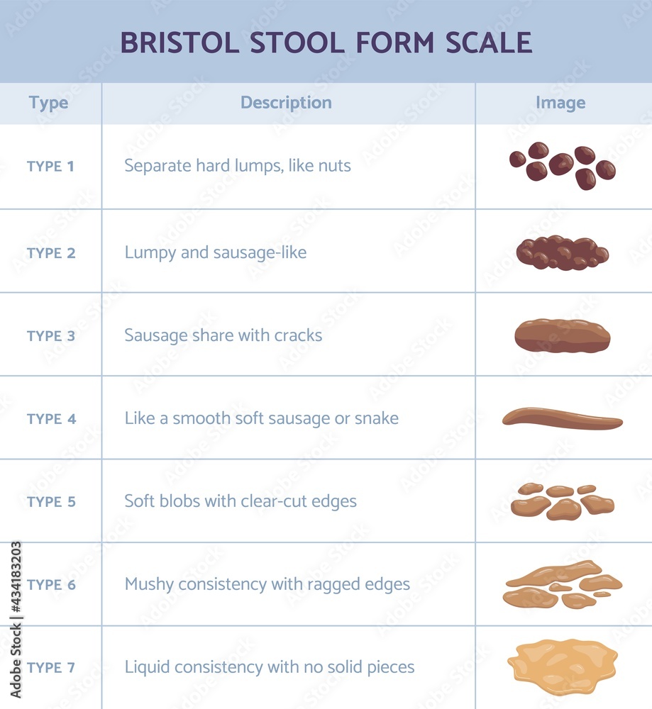 Bristol stool form scale infographic with faeces type flat vector ...