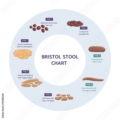 Bristol stool chart infographic, flat vector illustration isolated on white.
