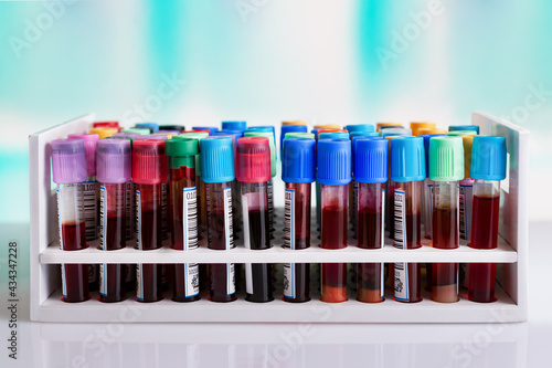 Tube tray with blood tubes samples for testing in the preanalytical lab. rack with tubes with blood samples from patients for analysis in the hematology laboratory. photo