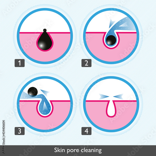 Skin pore cleansing process icons. Facial treatments colored icons. Treatment of skin diseases, sebum removal and pores cleaning and narrowing. Medical vector illustration