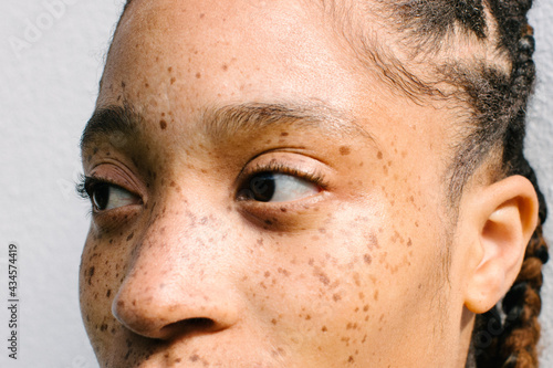 Close up portrait of girl with freckles photo