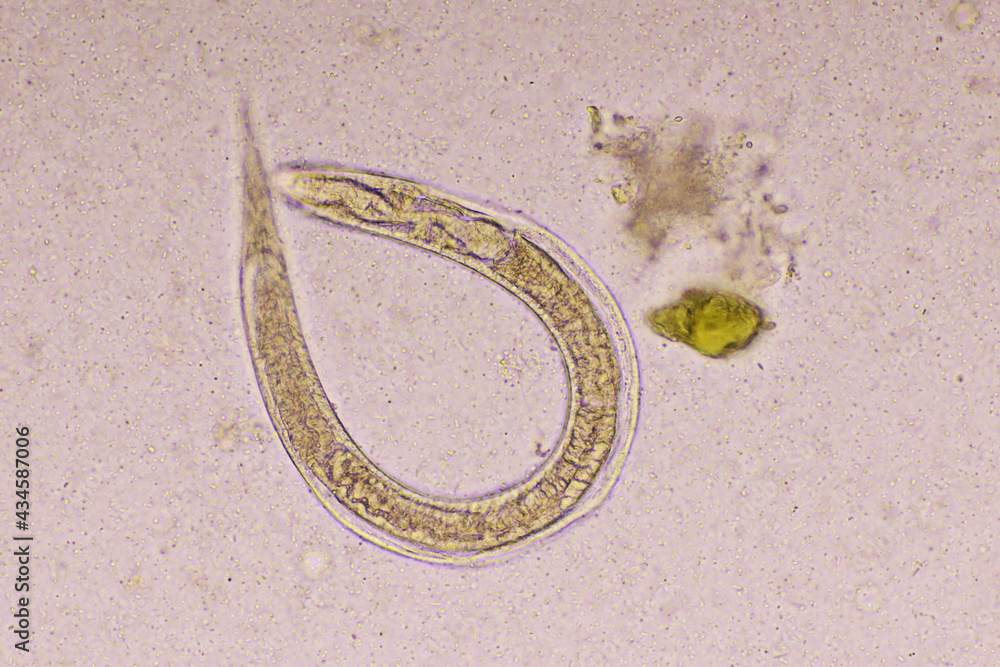 Strongyloides stercoralis or threadworm in human stool, analyze by microscope, original
