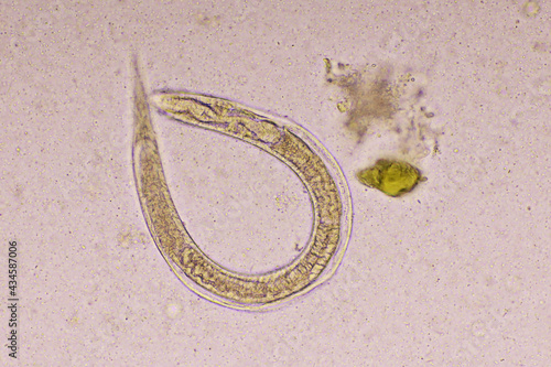 Strongyloides stercoralis or threadworm in human stool, analyze by microscope, original magnification 400x photo
