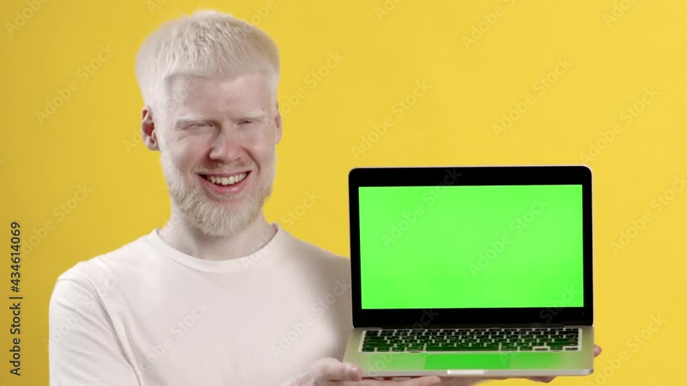 Albino Man Showing Laptop With Chroma Key Screen, Yellow Background Albino Man Showing Laptop With Chroma Key Screen, Yellow Background