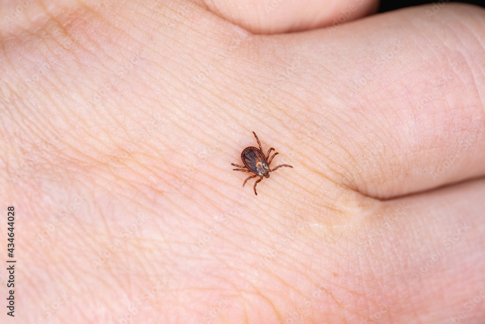 A tick on a man's hand is looking for where to bite.
