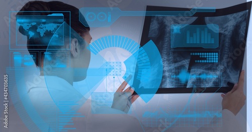 Digital interface with data processing over female doctor examining x-ray report
