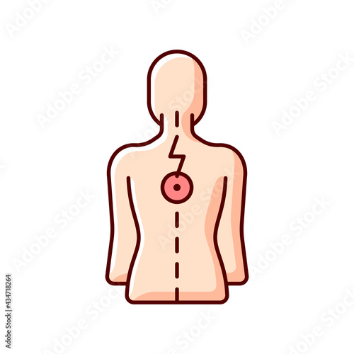 Pressure on spinal nerves RGB color icon. Muscle spasms. Pain between shoulder blades. Numbness, tingling. Damage to spinal cord. Vertebrae dislocation. Upper back pain. Isolated vector illustration