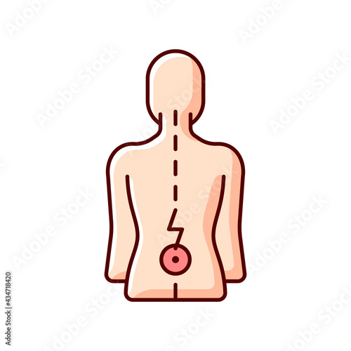 Lower back pain RGB color icon. Aging-related wear. Physical disability. Ruptured, bulging disc. Injury to connective tissue. Muscle weakness, numbness. Pressure on nerve. Isolated vector illustration