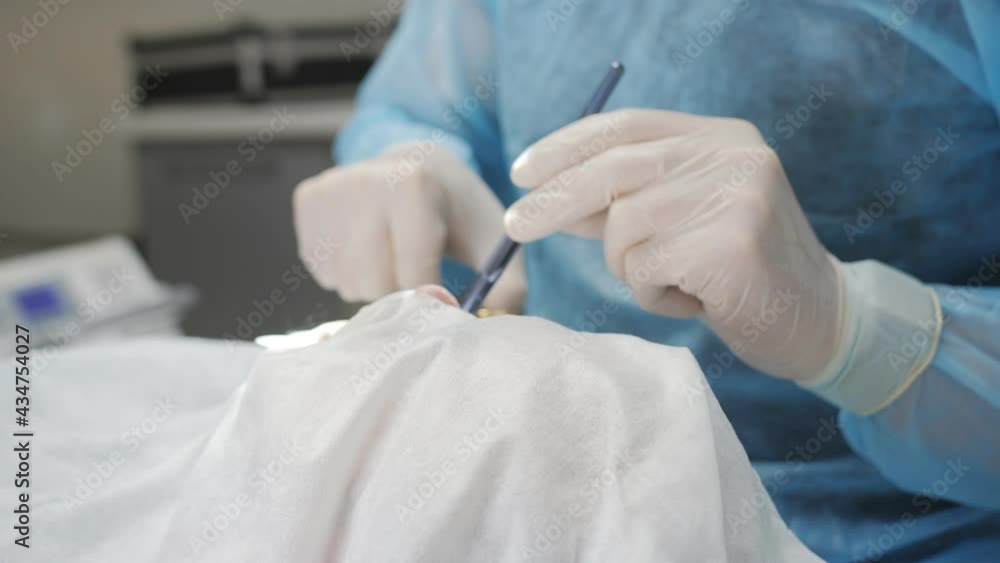 Surgery in a dental clinic. The dentist surgeon stitches the wound in