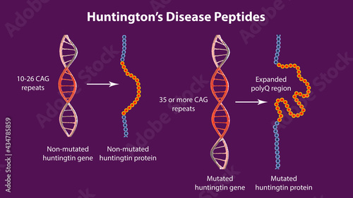 Molecular genesis of Huntington's disease, 3D illustration photo