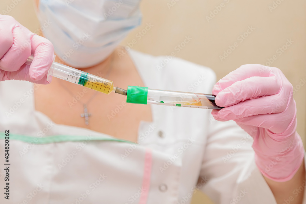 The specialist draws out the blood plasma from the test tube using a syringe. Plasmolifting, medical cosmetology The specialist draws out the blood plasma from the test tube using a syringe. Plasmolifting, medical cosmetology