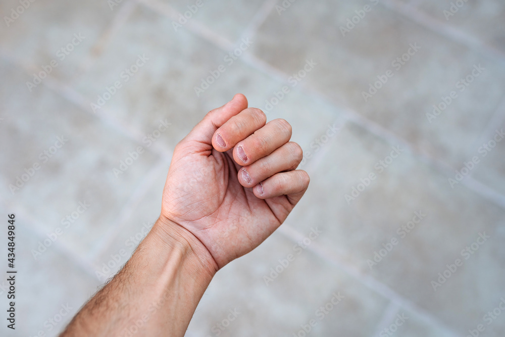 A man's hand with bitten and ugly fingernails. Bad care of hands A man's hand with bitten and ugly fingernails. Bad care of hands