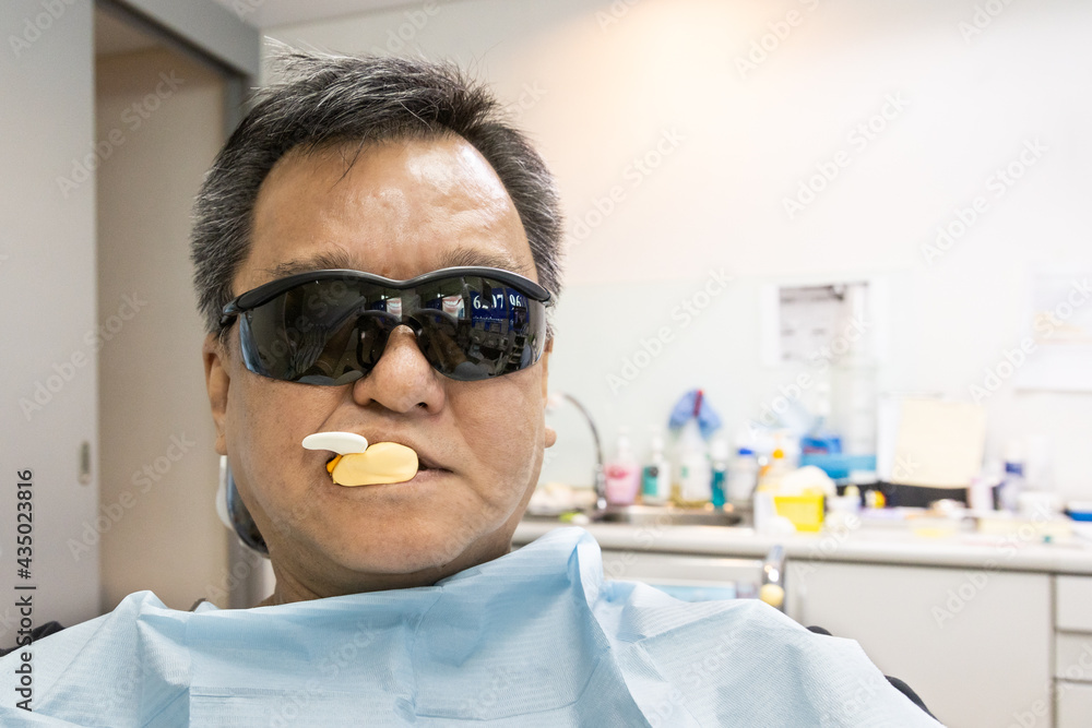 Dental patient fitted with material to obtain teeth imprint or impression Dental patient fitted with material to obtain teeth imprint or impression
