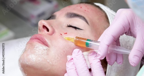 The doctor gives injections of blood plasma into the face of a young girl. Therapeutic procedure, plasmolifting photo