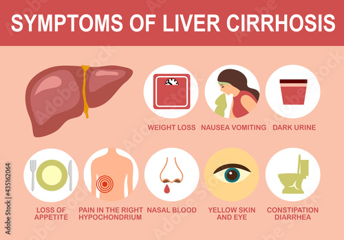 Liver cirrhosis symptom with useful advices infographic in flat design. Health care concept.