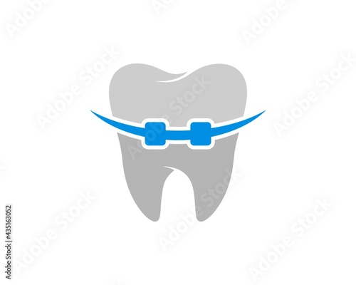 healthy tooth with blue braces inside