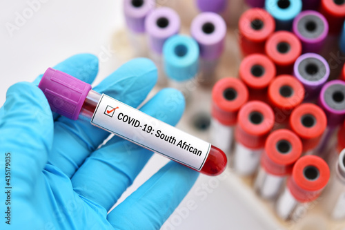 South African COVID-19 variant, blood sample tube positive with South African strain of COVID-19 virus 