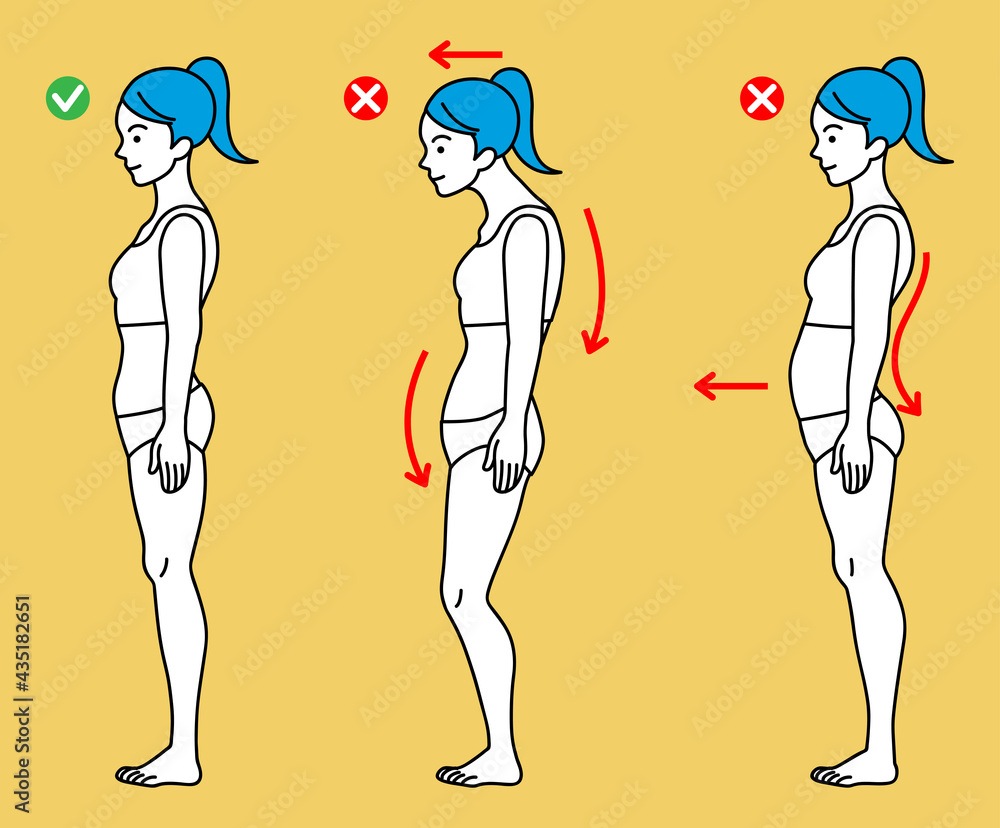 Three types standing posture - Women - obrazy, fototapety, plakaty 