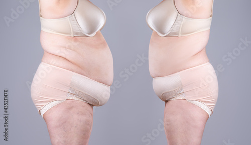 Woman's body before and after weight loss on gray background