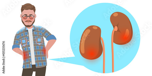 3D Flat Vector Conceptual Illustration of Kidney Stones Disease, Urinary System Disorders