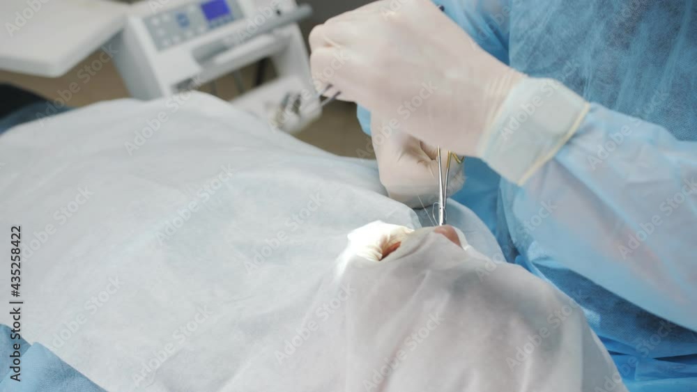 The dentist surgeon stitches the wound in the patient's mouth. Surgery