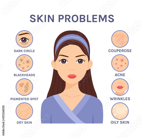Skin problems close-up. Beautiful Brunette Woman and facial Diseases: Acne, Blackheads,Dry,Oily,Wrinkles,Dark circles,Couperose,Pigmented spot,Flat color cartoon style.White background.Vector.