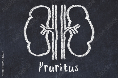Chalk drawing of human kidneys and medical term Pruritus. Concept of learning medicine