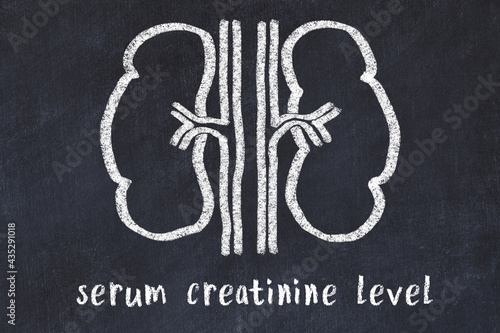 Chalk drawing of human kidneys and medical term serum creatinine level. Concept of learning medicine photo