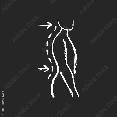 Lumbar lordosis chalk white icon on black background. Excessive inward spine curve. Saddleback appearance. Pain, discomfort. Difficulty with coordination. Isolated vector chalkboard illustration