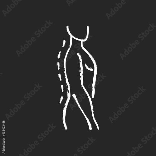 Standing posture correction chalk white icon on black background. Improving upright position. Spine natural curvature. Shoulders parallel with hips. Isolated vector chalkboard illustration © bsd studio