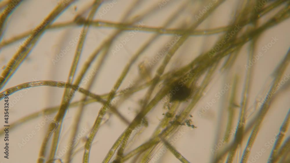Chloroplast Under a Microscope Dead Plant. Cell Division. Dead Plant Cell Structure. Virus Infection. Microbes Microorganisms Bacteria Under Microscope. GMO DNA. Chloroplast Under a Microscope Dead Plant. Cell Division. Dead Plant Cell Structure. Virus Infection. Microbes Microorganisms Bacteria Under Microscope. GMO DNA.